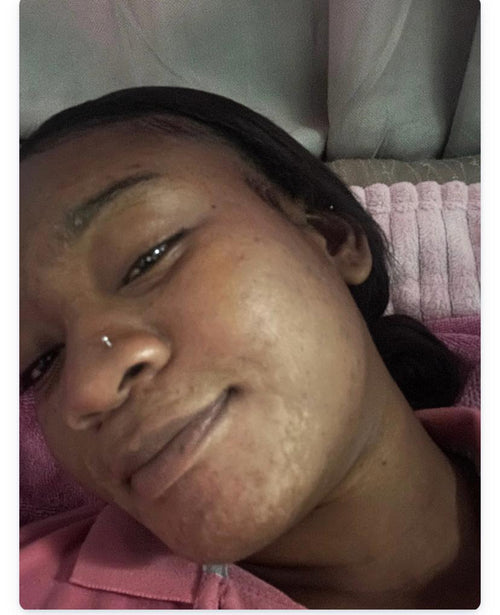 Alikare perfecting  Vitamin C Serum 2oz